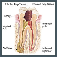 Tooth Diagram